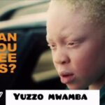 Story Ya Albino